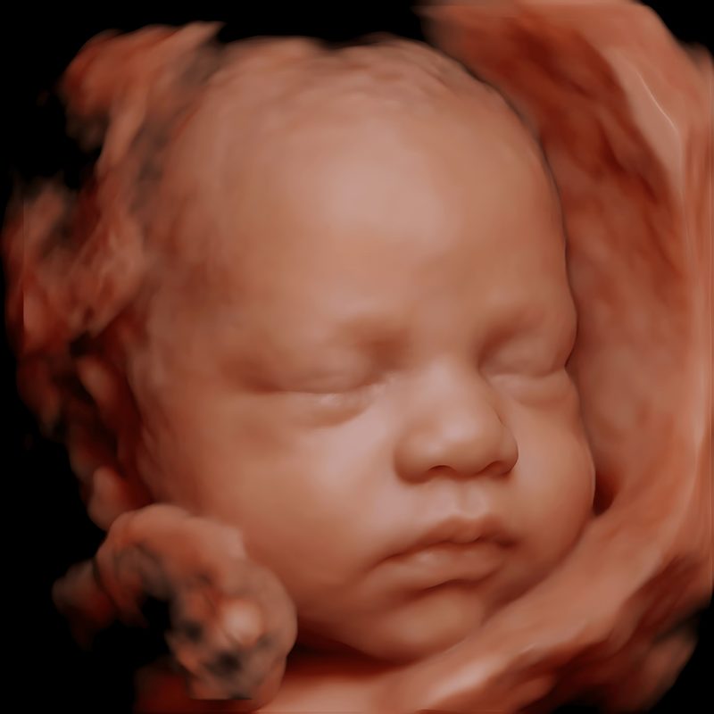 8K scan