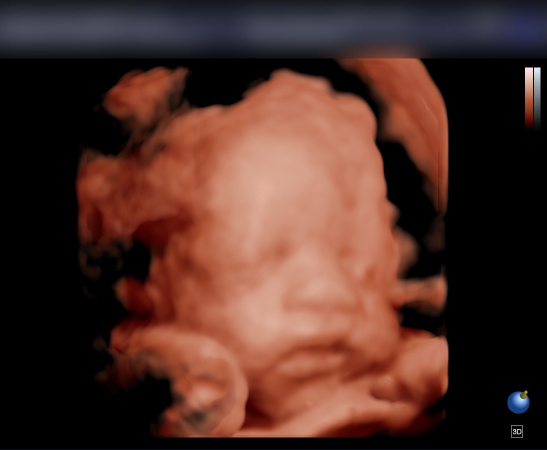 Original ultrasound scan
